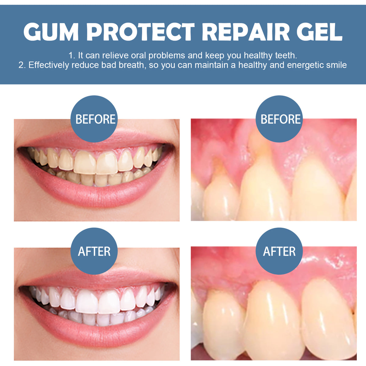 😱DENTISTS ARE SHOCKED By This Gum Protect！