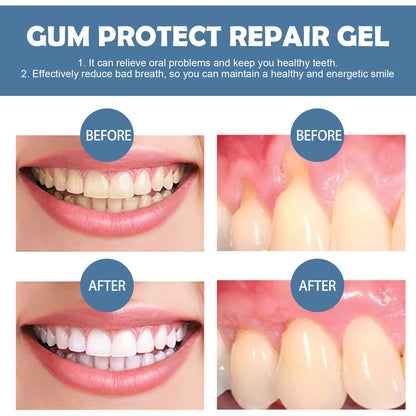 😱DENTISTS ARE SHOCKED By This Gum Protect！