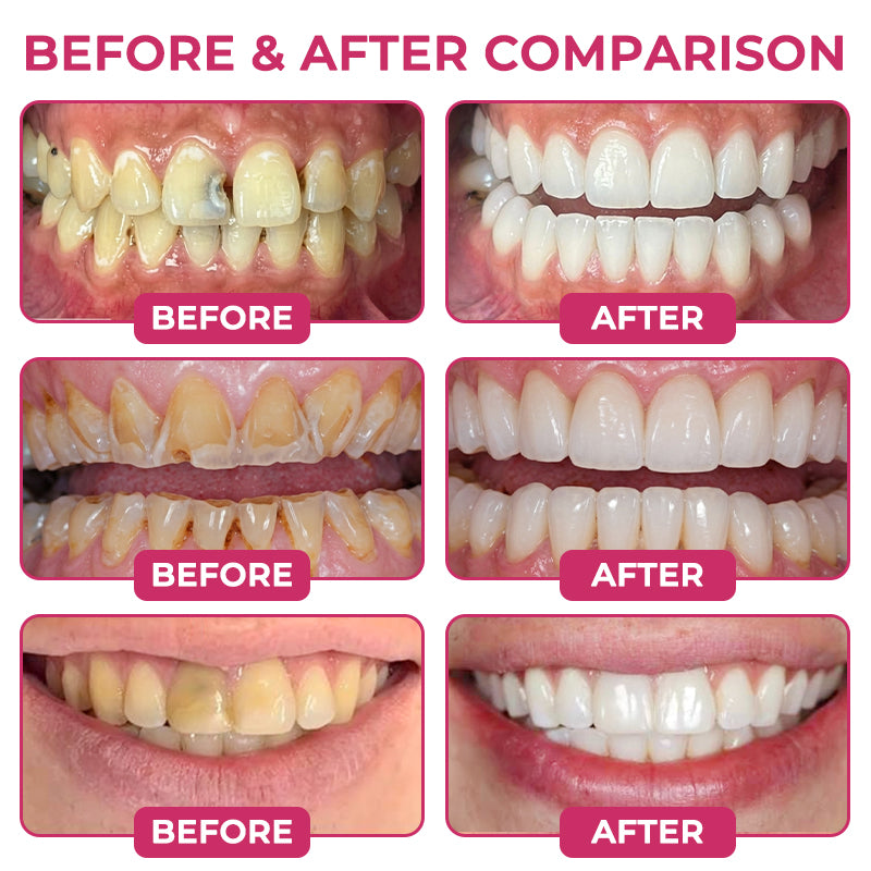 COUGEX® Natural Enamel Repair Gel | Cavity Repair & Remineralizing Treatment