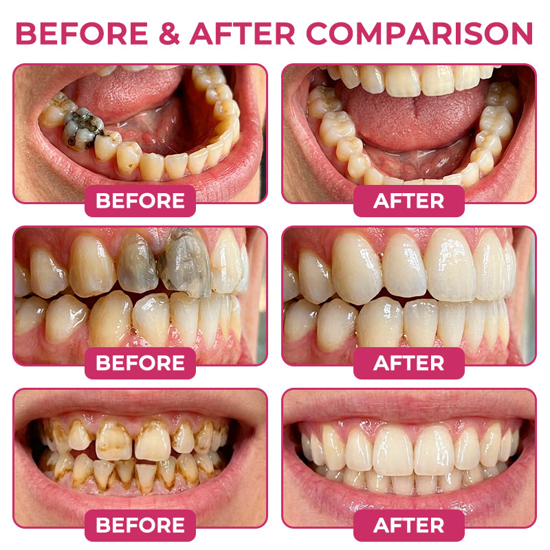 COUGEX® Natural Enamel Repair Gel | Cavity Repair & Remineralizing Treatment